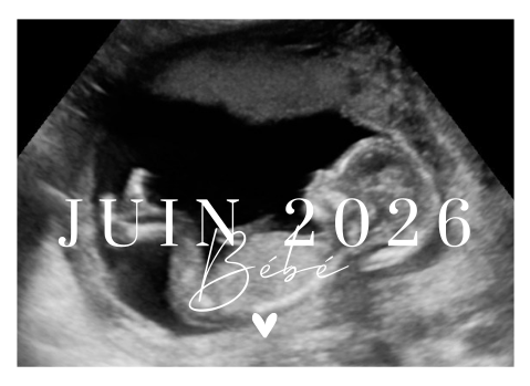 Annonce de grossesse originale Étiquette de vin avec échographie